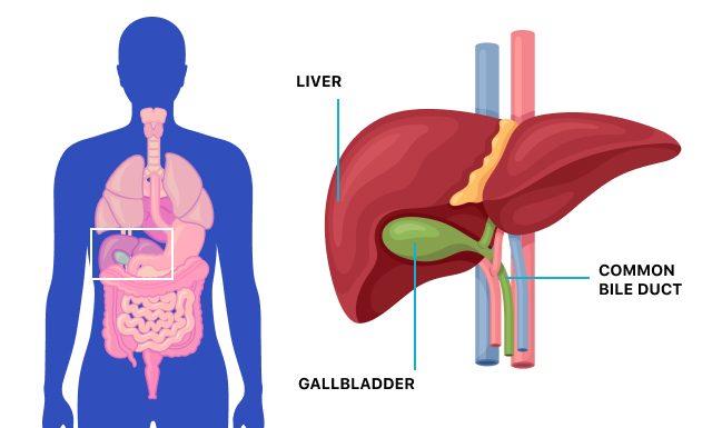 Causes, Symptoms and Treatment of Gall Stones | St.Theresas Hospital 